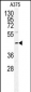 POLDIP2 Antibody (Center)