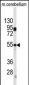 CPE Antibody (C-term)