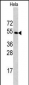 CPE Antibody (C-term)