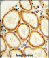 CASP2 Antibody (Center)