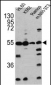 CASP2 Antibody (Center)