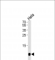 B2M Antibody (C-term Y86)