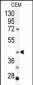 KRT19 Antibody (C-term)