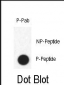 Phospho-FABP4(Y20) Antibody