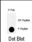 Phospho-TBK(S172) Antibody