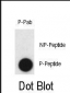 Phospho-CLDN2(Y224) Antibody
