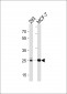 CA2 Antibody (C-term)