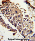 SERPINF1 Antibody (Center)