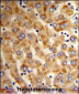 HYOU1 Antibody (Center)