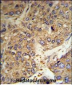 FGG Antibody (C-term)