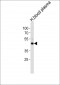 FGG Antibody (C-term)