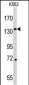 CD163 Antibody (N-term)