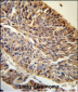 PITX1 Antibody (Center)