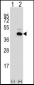 PITX1 Antibody (Center)