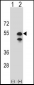 CPN1 Antibody (N-term)