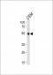 KLF5 Antibody (C-term)