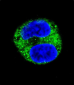 TYR  Antibody (Center)