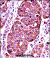 TYR  Antibody (Center)