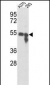 TYR  Antibody (Center)