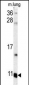 S100A6 Antibody (C-term)