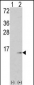 S100A6 Antibody (C-term)