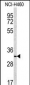 NQO1 Antibody (Center)