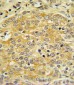 APOL1 Antibody (C-term)