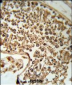 SERPINH1 Antibody (C-term)