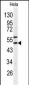 SERPINH1 Antibody (C-term)