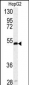 SERPINH1 Antibody (Center)