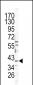 CATB Antibody (Center)