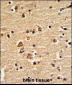 EN2 Antibody (C-term-2)