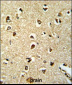 SEPT4 Antibody (N-term)