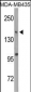 DNMT1 Antibody (S1105)