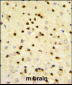 EBP1 Antibody (Center)