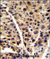 ENOB Antibody (Center)