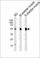 ENOB Antibody (Center)