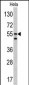 CA9 Antibody (Center)