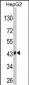 AGXT Antibody (Center)