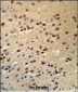 ALS2 Antibody (C-term)