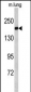 ALS2 Antibody (C-term)