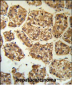 BLNK Antibody (Center)
