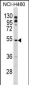 BLNK Antibody (Center)