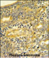 DPP8 Antibody (C-term)