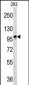 DPP8 Antibody (C-term)