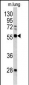 FLI1 Antibody (Center)