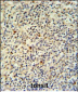 FLI1 Antibody (N-term K67)