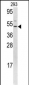 FLI1 Antibody (N-term K67)