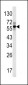 FIBB Antibody (C-term)