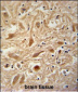 ARPC1A Antibody (Center)